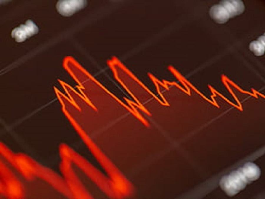 shares to buy