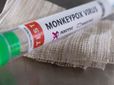 Monkeypox: అందుబాటులో ఆర్టీపీసీఆర్ కిట్
