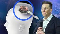  Elon Musk: ఎలోన్ మస్క్ సంచలన ప్రకటన.. మెదడులో చిప్ పెడతాడటా..