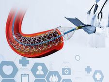 இதய நோயாளிகளுக்கு பயன்படும் stent-களின் விலை மீண்டும் உயர்வு..! 