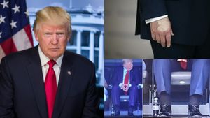 டிரம்புக்கு இருக்கும் உடல்நல பிரச்சினை.. கவனிக்க தவறினால் கால்களை அகற்ற நேரிடும் - மருத்துவர்கள்