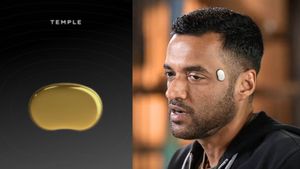 எவ்வளவு கொழுப்பு இருக்கு..? வேலையில் சேர புது நிபந்தனை விதித்த சோமேட்டோ தீபேந்தர் கோயல்.. !