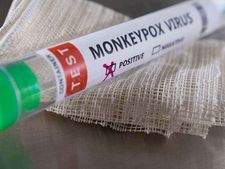 Monkeypox: అందుబాటులో ఆర్టీపీసీఆర్ కిట్