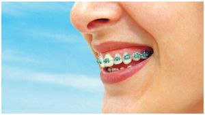  Amarinder Singh: ಕ್ಲಿನಿಕ್‌ನಲ್ಲಾದ ಕಹಿ ಅನುಭವ, ದೇಶದ ಅತಿದೊಡ್ಡ ಡೆಂಟಲ್‌ ಚೈನ್‌ ಕಟ್ಟಿದ ಅಮರಿಂದರ್‌ ಸಿಂಗ್‌!