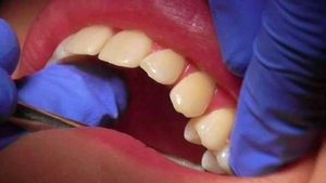 ಶೀಘ್ರದಲ್ಲೇ ಬಿಬಿಎಂಪಿಯ ಎಲ್ಲಾ 8 ವಲಯಗಳಲ್ಲಿ ಉಚಿತ ದಂತ ಚಿಕಿತ್ಸಾಲಯ ಪ್ರಾರಂಭ 