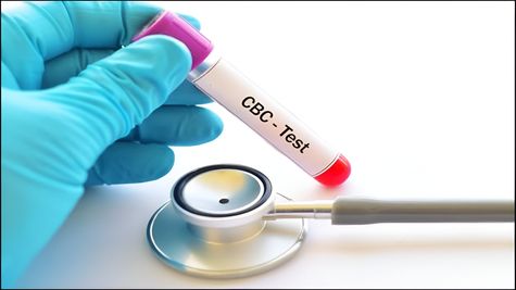 Can CBC Tests Help Detect Chronic Conditions Early?