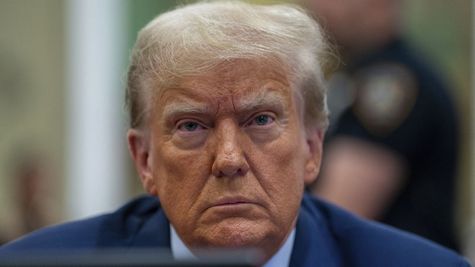 Trump's Health Under Scrutiny: White House Clarifies Chronic Condition And Bruising