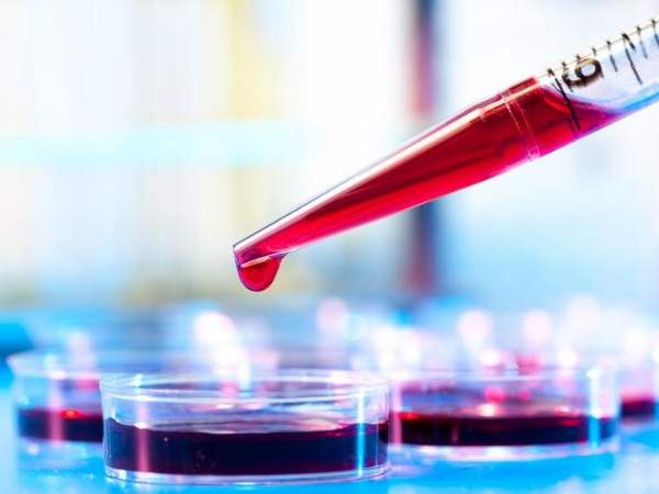 एक बच्चे की बदल दी जिन्दगी