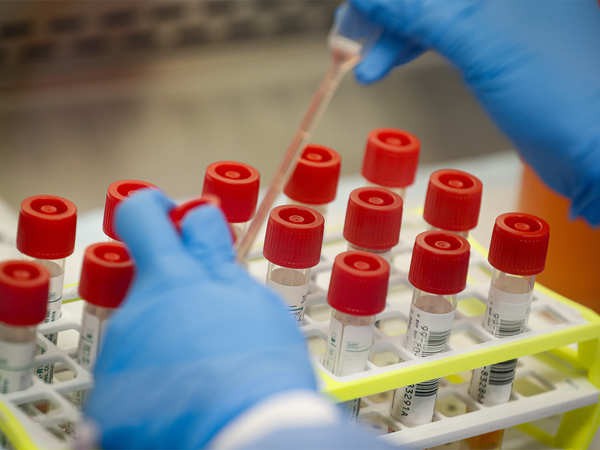 काफी खराब है स्थिति