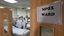ಭಾರತದಲ್ಲಿ Mpox ದೃಢ, ಇದು ಮನುಷ್ಯರಲ್ಲಿ ಹೇಗೆ ಹರಡುತ್ತದೆ ತಿಳಿಯಿರಿ 