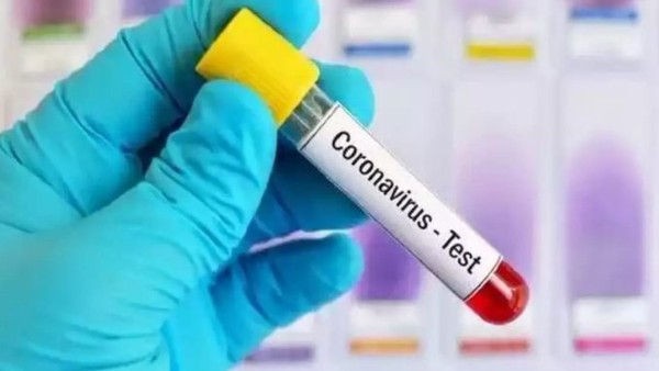  കോവിഡ് പരിശോധന