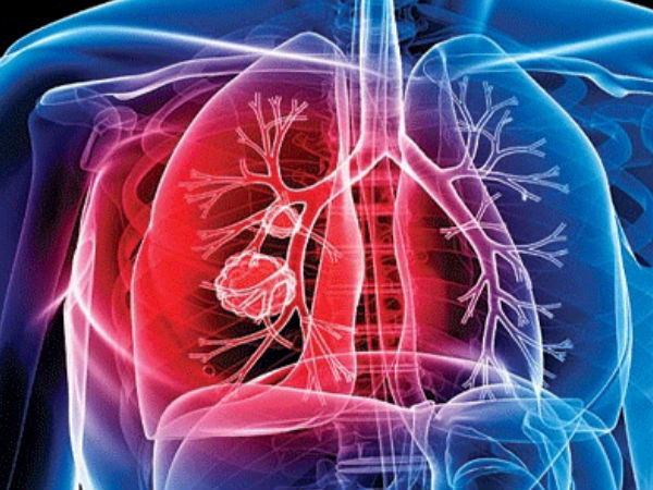 காசநோயாளிகள் 