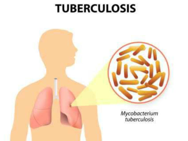 600கோடி ரூபாய்