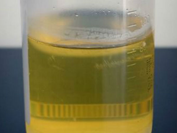 பிளாஸ்டிக் பாட்டிலில் சிறுநீர் 