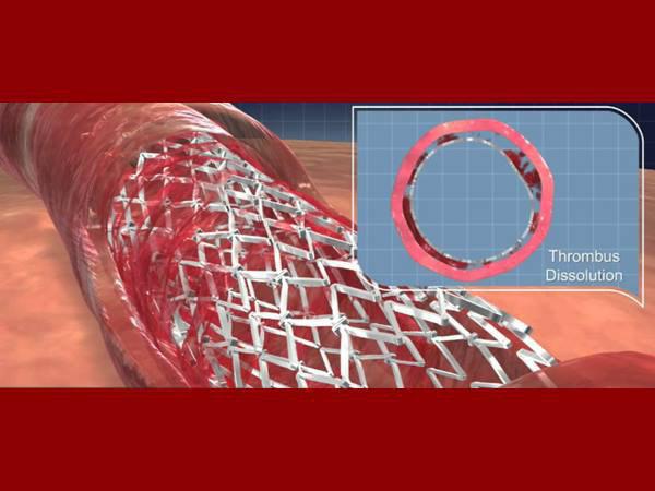 இன்றில் இருந்து 