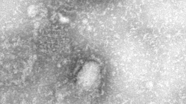 ஆபத்தில் முதல் 10 நாடுகள் 