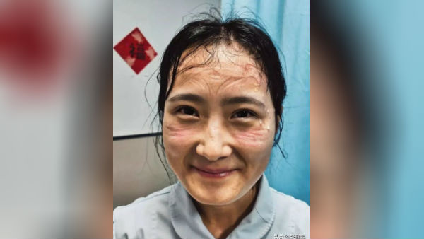 கொரோனா வைரஸ் 