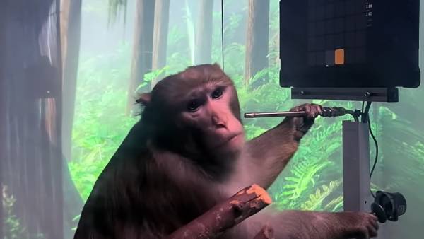  செயற்கை கை, கால்