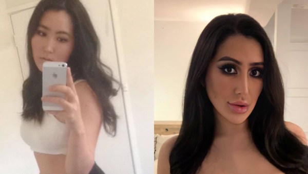 அழகாக மாற அறுவை சிகிச்சை 