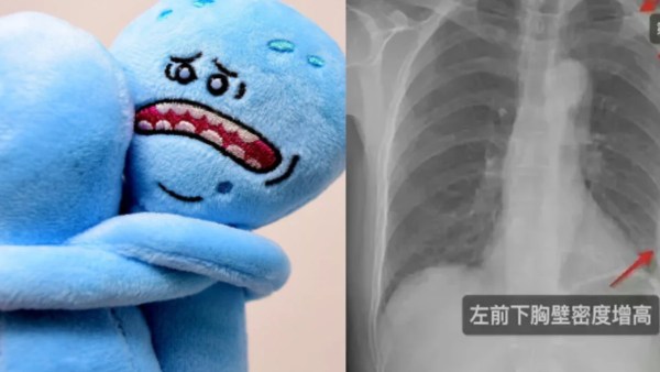 விலா எலும்புகள்