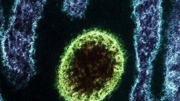  75% உயிரிழப்பு பாதிப்பு 