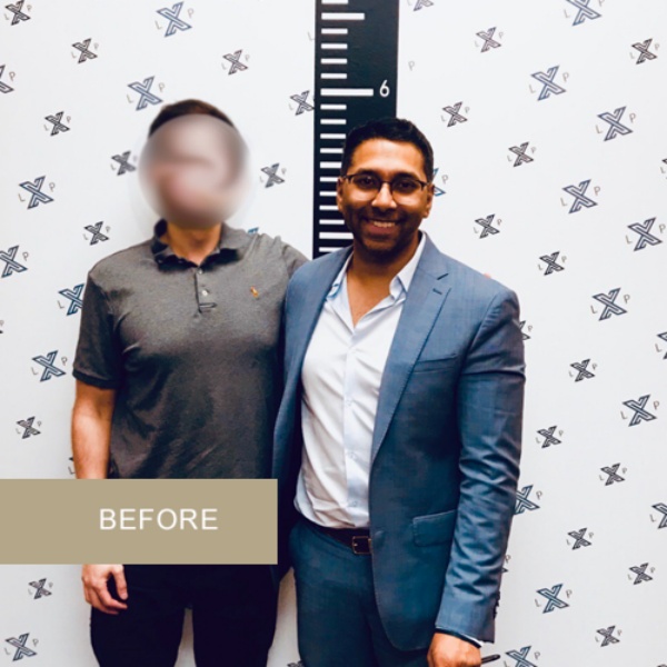 LimbplastX மருத்துவமனை