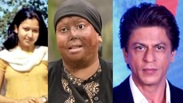 வங்கி கணக்கு திறக்க தடை.. ஆசிட் வீச்சால் பாதிக்கப்பட்ட பெண்ணின் பதிவு..! 