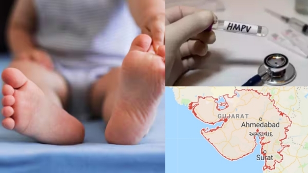 தெற்கில் இருந்து வடக்கிற்கு சென்ற HMPV வைரஸ்.. குஜராத்தில் அடுத்த குழந்தை பாதிப்பு..!! 