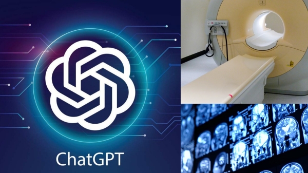இதுதான் AI பவர்!. MRI ரிப்போர்ட்டையே தூக்கி சாப்பிட்ட ChatGPT!. என்ன நடந்தது?
