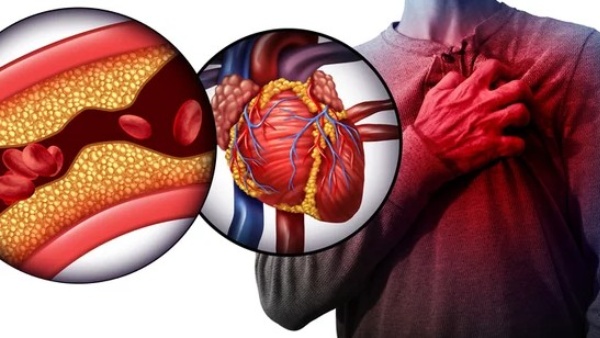 இளம் தலைமுறையினரை பயமுறுத்தும் இதய பாதிப்புகள் - கோவை மருத்துவர் திருவேங்கடம் விளக்கம் 