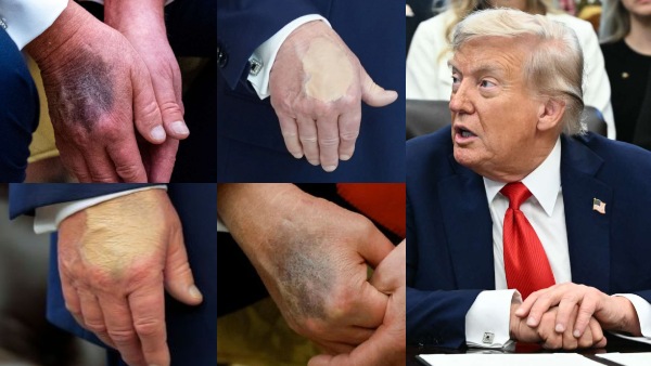 Trump Is Dead.. டிவிட்டரில் டிரெண்டாகும் ஹேஷ்டேக்.. டிரம்ப் கையில் இருந்தது என்ன..? Trump Is Dead.. டிவிட்டரில் டிரெண்டாகும் ஹேஷ்டேக்.. டிரம்ப் கையில் இருந்தது என்ன..?