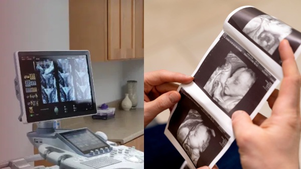 AI கருவிகளால் மறைமுகமாக பரவி வரும் மிகப்பெரிய சமூக ஆபத்து..!! தடுத்து நிறுத்துமா மத்திய அரசு?