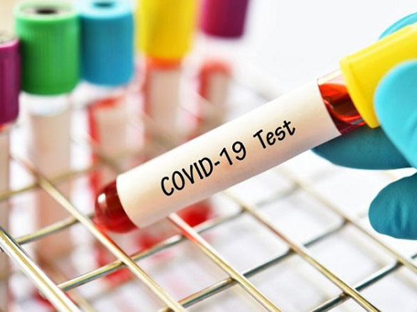 ఫెవికోవిడ్ బ్రాండ్