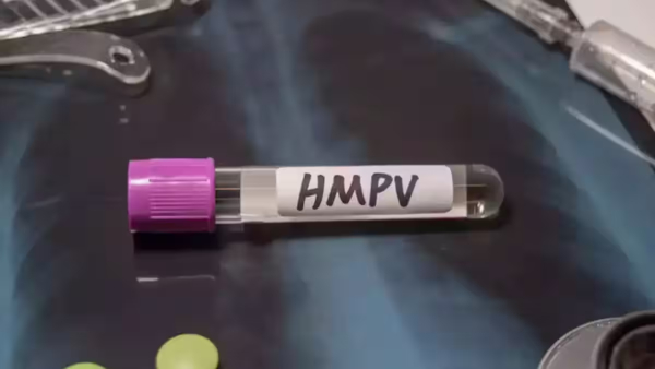 How much will HMPV tests cost What you need to know about lab fees